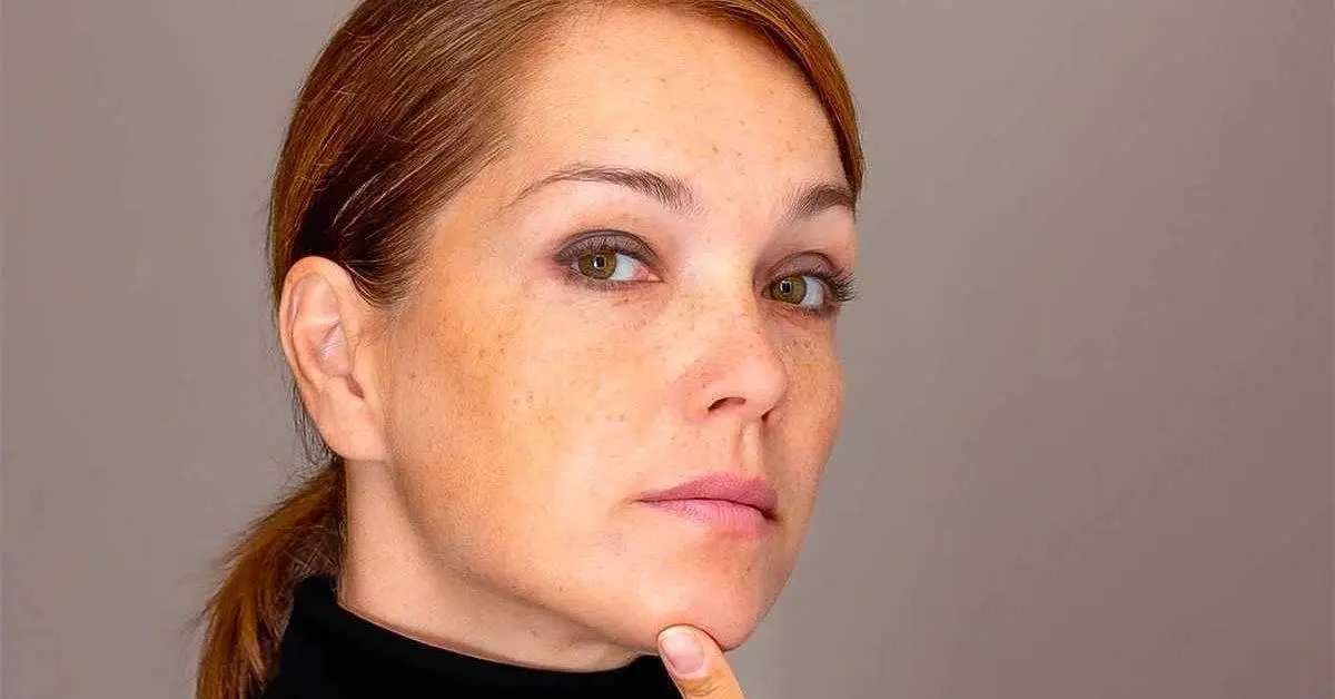 5 dicas para reduzir manchas marrons no rosto: soluções naturais para uma pele brilhante